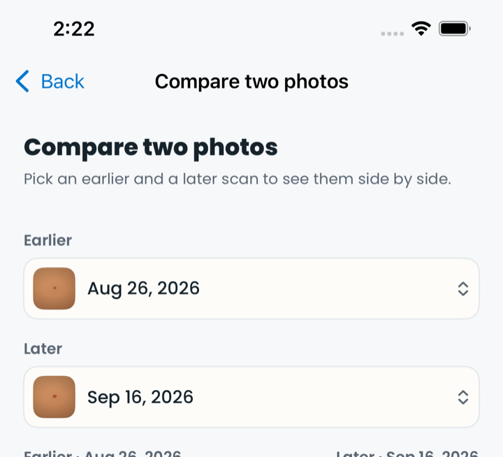 SkinLogs Compare screen showing earlier and later scan selectors