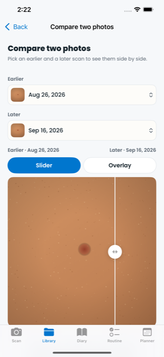 SkinLogs Compare screen in slider mode