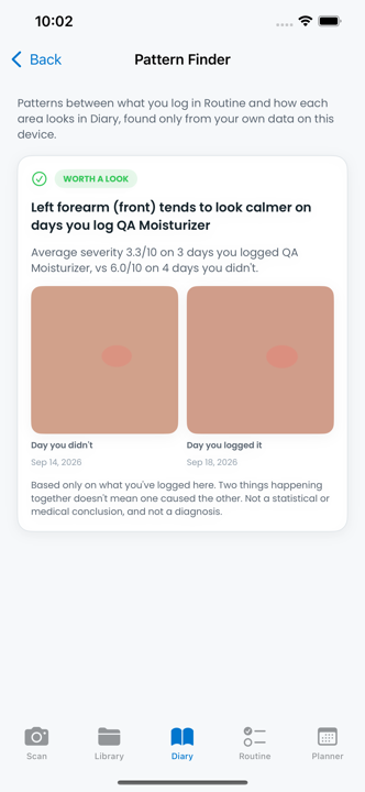 SkinLogs Routine Pattern Finder showing a before and after comparison for a tagged product