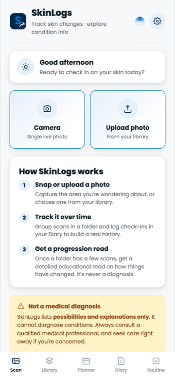 SkinLogs scan screen with camera and upload options